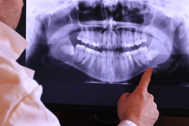 Best Emergency Dentist for Lost Fillings or Crowns in Kurtistown, HI